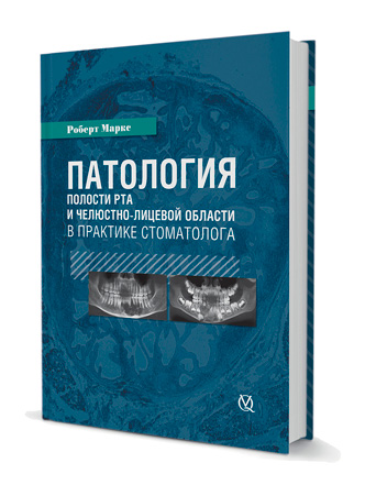 Патология полости рта в практике стоматолога/Р. Маркс