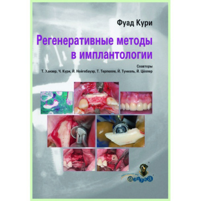 Регенеративные методы в имплантологии / Ф. Кури